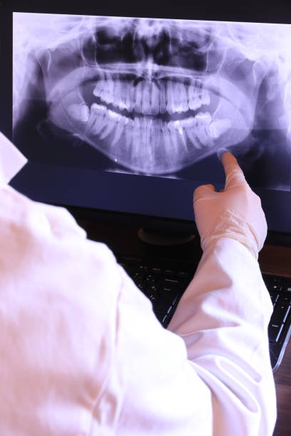 Best Teeth Whitening  in Sequim, WA
